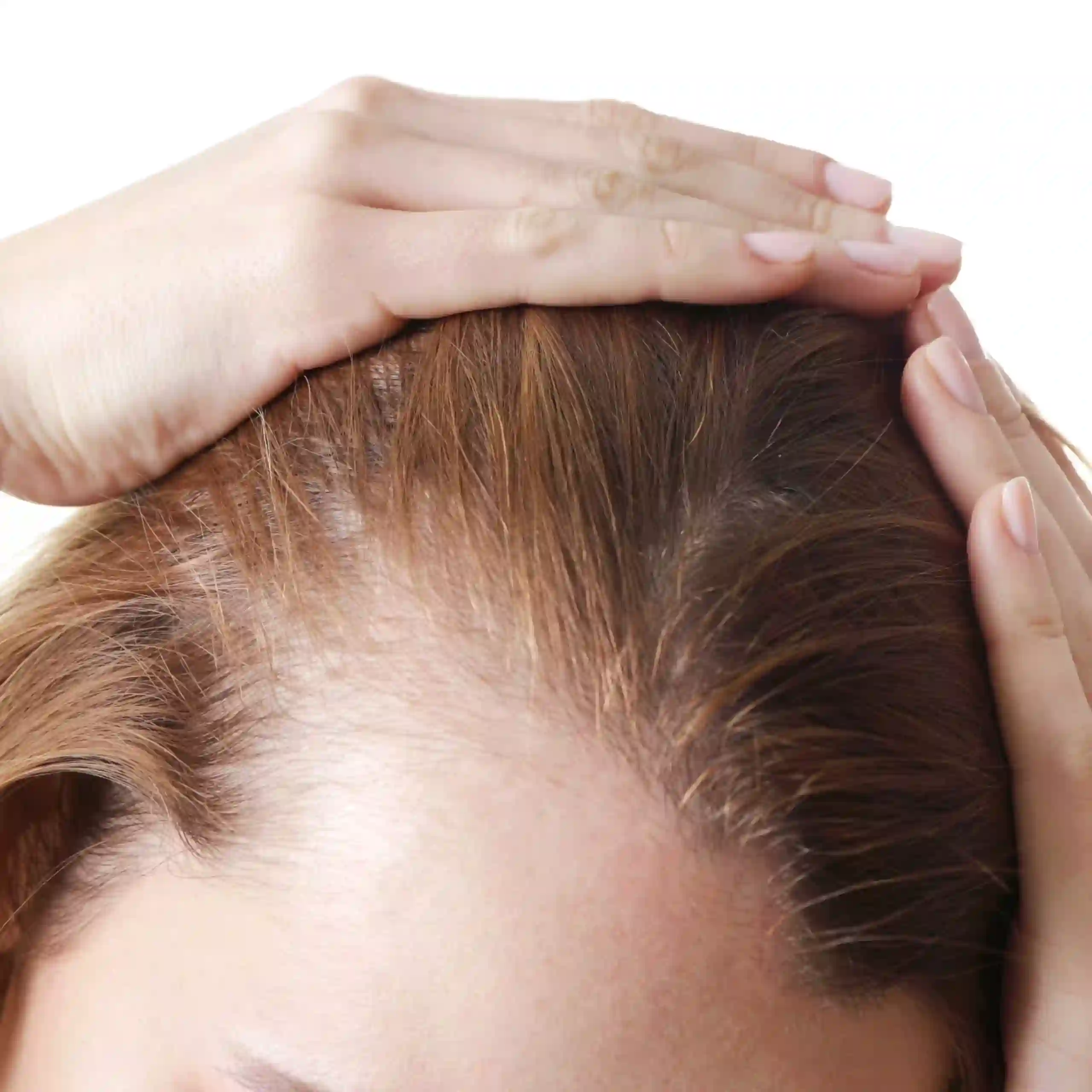 يوجد نوعان من زراعة الشعر للنساء في الرياض